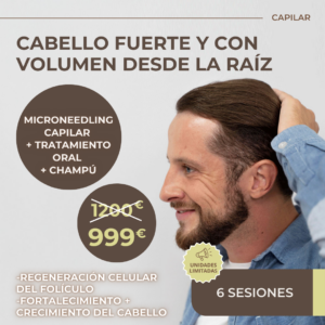 MICRONEEDLING CAPILAR + TRATAMIENTO ORAL + CHAMPÚ