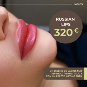 Russian Lips