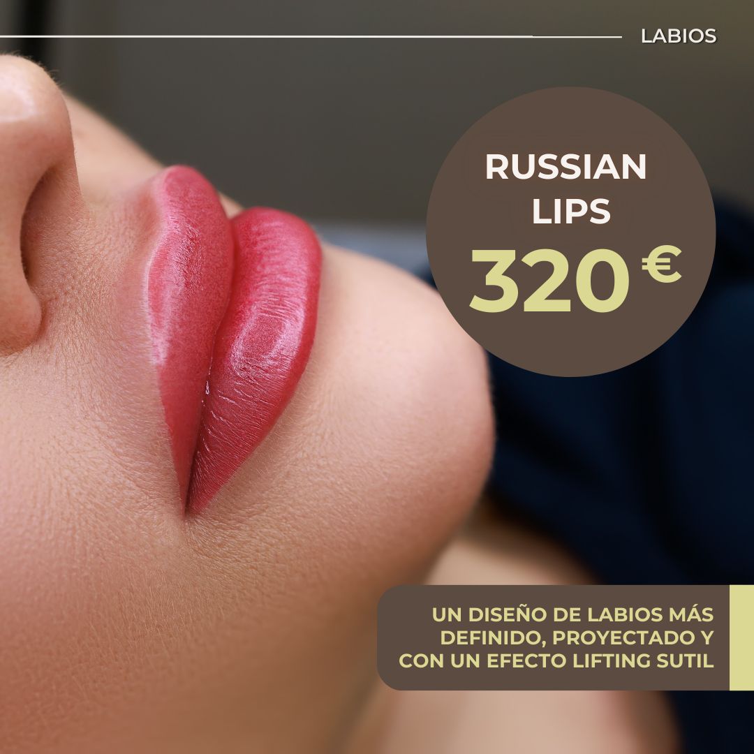 Russian Lips